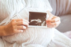 Pregnant Surrogate holding an ultrasounds